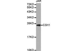 Western blot analysis of extracts of JAR cell line, using CSH1 antibody.