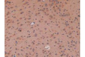 IHC-P analysis of Mouse Brain Tissue, with DAB staining. (APC anticorps  (AA 2636-2845))