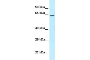 WB Suggested Anti-CCT3 Antibody Titration: 1. (CCT3 anticorps  (C-Term))