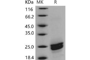 Western Blotting (WB) image for Phospholipase A2, Group XIIB (PLA2G12B) protein (His tag) (ABIN7320191)