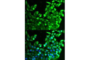 Immunofluorescence analysis of MCF-7 cells using FGFR2 antibody (ABIN5971103). (FGFR2 anticorps)