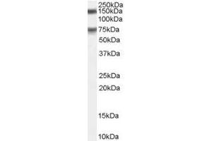 Image no. 1 for anti-Maternal Embryonic Leucine Zipper Kinase (MELK) (C-Term) antibody (ABIN374073) (MELK anticorps  (C-Term))