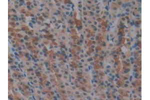 IHC-P analysis of Rat Stomach Tissue, with DAB staining. (TXNRD1 anticorps  (AA 208-433))