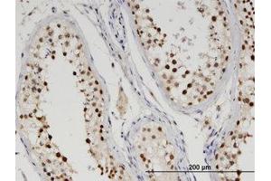Image no. 1 for anti-tyrosyl-DNA phosphodiesterase 2 (TDP2) (AA 1-363) antibody (ABIN599560) (TDP2 anticorps  (AA 1-363))