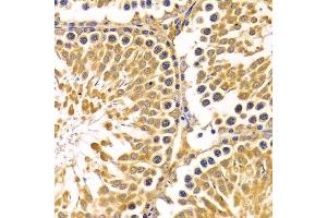 Immunohistochemistry of paraffin-embedded rat testis using PIBF1 Antibody. (PIBF1 anticorps)