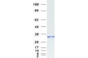Validation with Western Blot