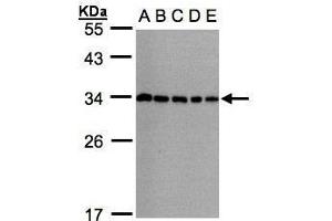 WB Image Sample(30μg whole cell lysate) A: 293T B: A431 , C: H1299 D: HeLa S3 , E: Hep G2 , 12% SDS PAGE antibody diluted at 1:1000 (CHMP5 anticorps)