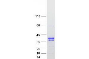 Validation with Western Blot