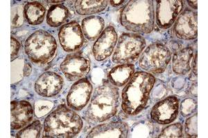 Image no. 2 for anti-3-Oxoacyl-ACP Synthase, Mitochondrial (OXSM) (AA 78-343) antibody (ABIN1491676) (OXSM anticorps  (AA 78-343))