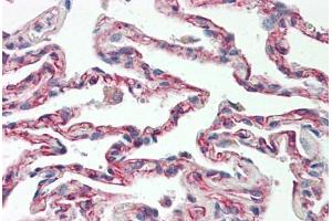 Image no. 2 for anti-TNFRSF1A-Associated Via Death Domain (TRADD) (AA 251-300) antibody (ABIN2879132) (TRADD anticorps  (AA 251-300))