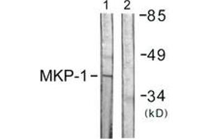 Western blot analysis of extracts from Jurkat cells, using MKP1 (Ab-359) Antibody.