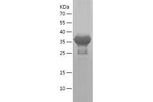 Western Blotting (WB) image for Ras Homolog Gene Family, Member T2 (RHOT2) (AA 392-541) protein (His-IF2DI Tag) (ABIN7124789)