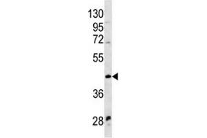 WNT9A antibody western blot analysis in NCI-H460 lysate (WNT9A anticorps  (AA 216-244))