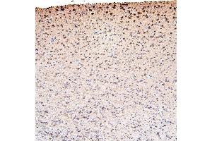 IHC analysis of CDK5 using anti-CDK5 antibody (ABIN6719393). (CDK5 anticorps  (AA 1-226))