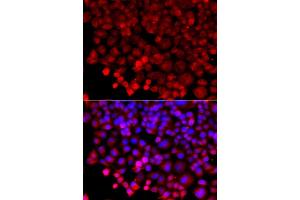 Immunofluorescence analysis of A549 cell using HARS antibody. (HARS1/Jo-1 anticorps)