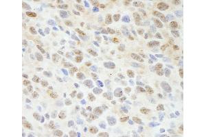 Immunohistochemistry (IHC) image for anti-Mitogen-Activated Protein Kinase Associated Protein 1 (MAPKAP1) (C-Term) antibody (ABIN7448795) (MAPKAP1 anticorps  (C-Term))