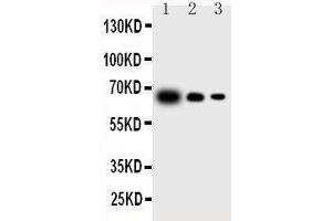 Western Blotting (WB) image for anti-Interleukin 23, alpha subunit p19 (IL23A) (AA 29-48), (N-Term) antibody (ABIN3043197) (IL23A anticorps  (N-Term))