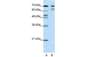 WB Suggested Anti-TCF3  Antibody Titration: 0. (TCF3 anticorps  (N-Term))