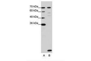 Image no. 3 for anti-LSM2 Homolog, U6 Small Nuclear RNA Associated (LSM2) (C-Term) antibody (ABIN202014) (LSM2 anticorps  (C-Term))