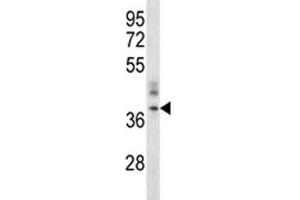 CRACM1 antibody western blot analysis in A375 lysate. (ORAI1 anticorps  (AA 269-298))