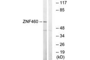 Western blot analysis of extracts from LOVO cells, using ZNF460 Antibody.