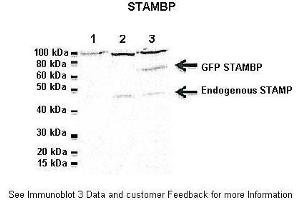 Lanes:  1: 20ug Jukart cell lysate, 2: 20ug untransfected Hela lysate, 3: 20ug GFP-STAMBP transfected HeLa lysate Primary Antibody Dilution:  1:1000 Secondary Antibody:  Goat anti-rabbit-HRP Secondary Antibody Dilution:  1:2000 Gene Name:  CDC26 Submitted by:  Dr. (CDC26 anticorps  (Middle Region))