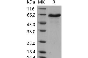 Western Blotting (WB) image for delta-Like 1 (DLL1) (Active) protein (His tag) (ABIN7320250) (DLL1 Protein (His tag))