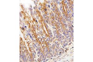 Immunohistochemical analysis of paraffin-embedded M. (Cytochrome C1 anticorps  (AA 142-176))