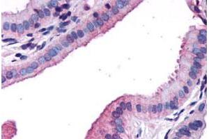 Immunohistochemical staining of human gallbladder, epithelium with CCKAR polyclonal antibody . (CCKAR anticorps  (N-Term))
