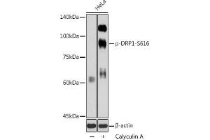 Western blot analysis of extracts of HeLa cells, using Phospho-DRP1-S616 antibody  at 1:1000 dilution.