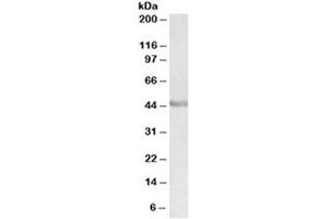 Western blot testing of human duodenum lysate with PAX3 antibody at 0. (Paired Box 3 anticorps)