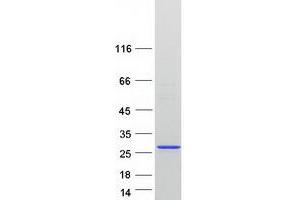 Validation with Western Blot