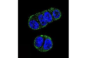 Confocal immunofluorescent analysis of FOLH1 Antibody (N-term) (ABIN657630 and ABIN2846626) with ZR-75-1 cell followed by Alexa Fluor 488-conjugated goat anti-rabbit lgG (green).