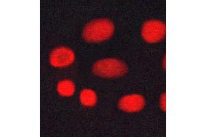 ABIN6269045 staining MCF-7 cells by ICC/IF. (CHEK1 anticorps  (Internal Region))