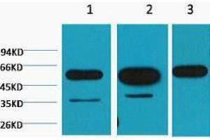 Western Blotting (WB) image for anti-Tubulin, beta (TUBB) antibody (ABIN3178688) (TUBB anticorps)