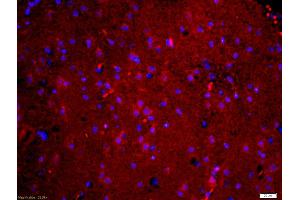 Formalin-fixed and paraffin embedded mouse brain labeled with Anti-phospho-Tau protein(Ser396) Polyclonal Antibody, Unconjugated (ABIN746453) at 1:200 followed by conjugation to the secondary antibody Goat Anti-Rabbit IgG, Cy3 conjugated used at 1:200 dilution for 40 minutes at 37°C and DAPI staining (tau anticorps  (pSer396))
