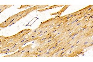 Detection of SPR in Mouse Cardiac Muscle Tissue using Polyclonal Antibody to Sepiapterin Reductase (SPR) (SPR anticorps  (AA 1-261))