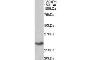 Western Blotting (WB) image for anti-V-Set Domain Containing T Cell Activation Inhibitor 1 (VTCN1) (Internal Region) antibody (ABIN2465019) (VTCN1 anticorps  (Internal Region))
