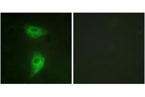 Immunofluorescence analysis of HeLa cells, using IGF2R (Ab-2409) Antibody. (IGF2R anticorps  (AA 2381-2430))