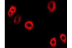 Immunofluorescent analysis of UBE2C staining in Hela cells.