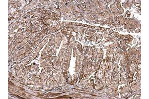 IHC-P Image MMP1 antibody detects MMP1 protein at secreted on mouse prostate by immunohistochemical analysis.
