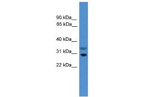 WB Suggested Anti-RGS18 Antibody Titration:  0. (RGS18 anticorps  (Middle Region))