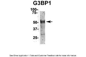 IP Suggested Anti-G3BP1 Antibody Positive Control: NT2 CELL/BRAIN TISSUE (G3BP1 anticorps  (N-Term))