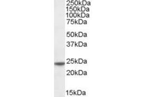 ABIN185188 (0. (Transgelin anticorps  (C-Term))
