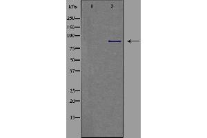 Western blot analysis of extracts from COLO cells, using CDH9 antibody. (Cadherin 9 anticorps  (Internal Region))