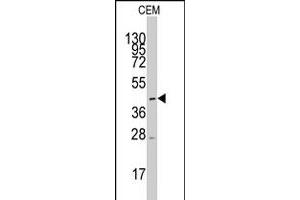 Western blot analysis of SLC16A1 polyclonal antibody  in CEM cell line lysates (35 ug/lane).