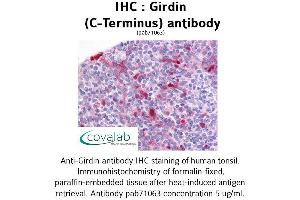 Image no. 1 for anti-Coiled-Coil Domain Containing 88A (CCDC88A) (C-Term) antibody (ABIN1734702) (Girdin anticorps  (C-Term))