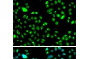 Immunofluorescence analysis of MCF-7 cells using L3MBTL3 Polyclonal Antibody (L3MBTL3 anticorps)