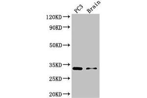 Western Blot Positive WB detected in: PC-3 whole cell lysate, Mouse brain tissue All lanes: HOXB13 antibody at 3 μg/mL Secondary Goat polyclonal to rabbit IgG at 1/50000 dilution Predicted band size: 31 kDa Observed band size: 31 kDa (HOXB13 anticorps  (AA 1-161))