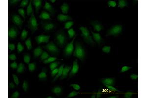 Immunofluorescence of monoclonal antibody to SMAD1 on HeLa cell.